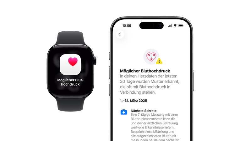 Mitteilung: M?glicher Bluthochdruck auf der Apple Watch Series 11, ausführlichere Mitteilung auf dem iPhone
