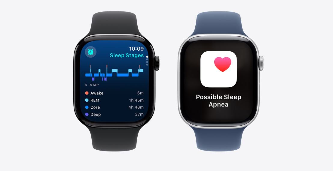 Two Apple?Watch?Series?10. The first shows Sleep Stages data. The second shows a Possible Sleep Apnea notification.