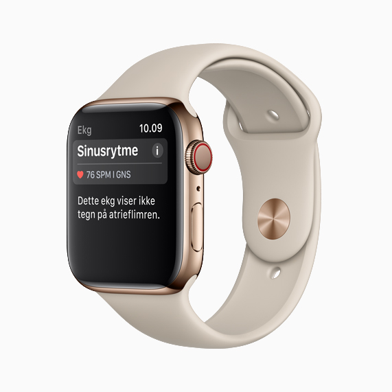 Apple Watch Series 4 viser sinusrytme.