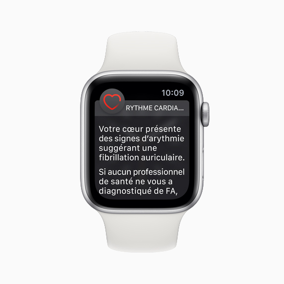 Cadran d’Apple?Watch avec la notification d’arythmie.