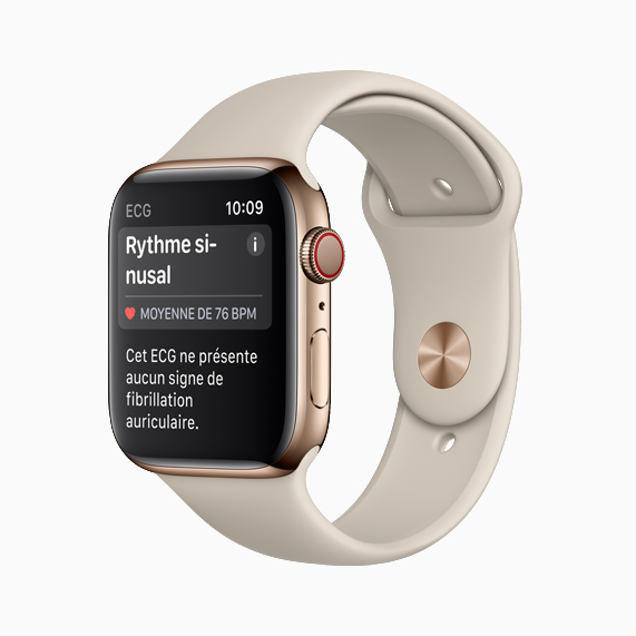 L’Apple?Watch Series?4 affichant un rythme sinusal.