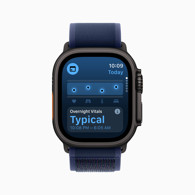 Apple Watch Ultra 2’de Ya?am Bulgular? uygulamas? g?steriliyor.
