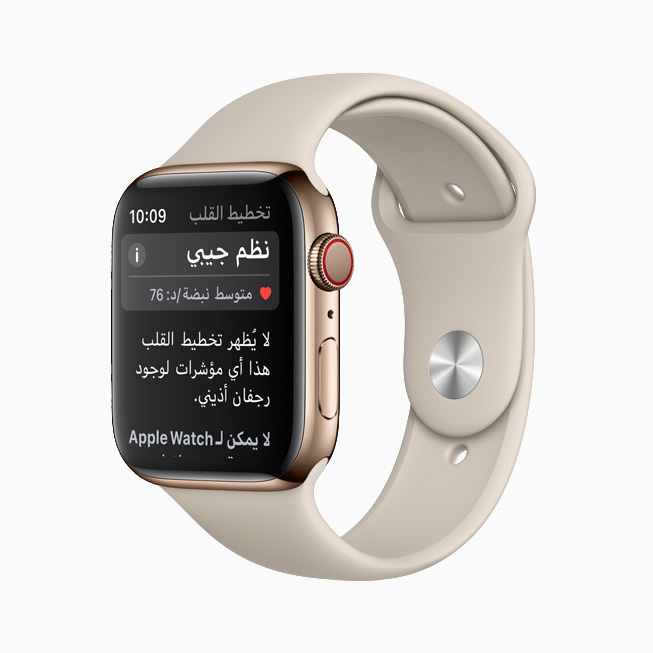 ????? ????? ?????? ????? ?? ????? ????? ????? ??? Apple Watch. 