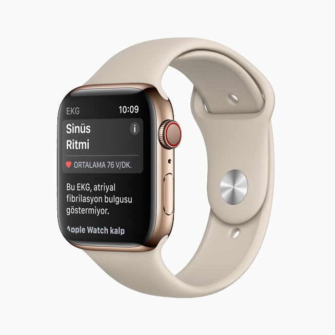 Apple Watch’taki EKG uygulamas?nda g?sterilen Sinüs Ritmi bildirimi. 